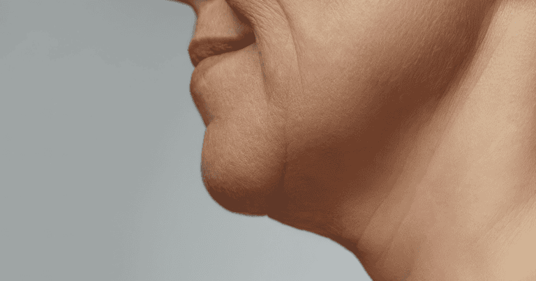 Revitalizing the Neck and Jawline:  Practical Strategies for a Firmer Profile